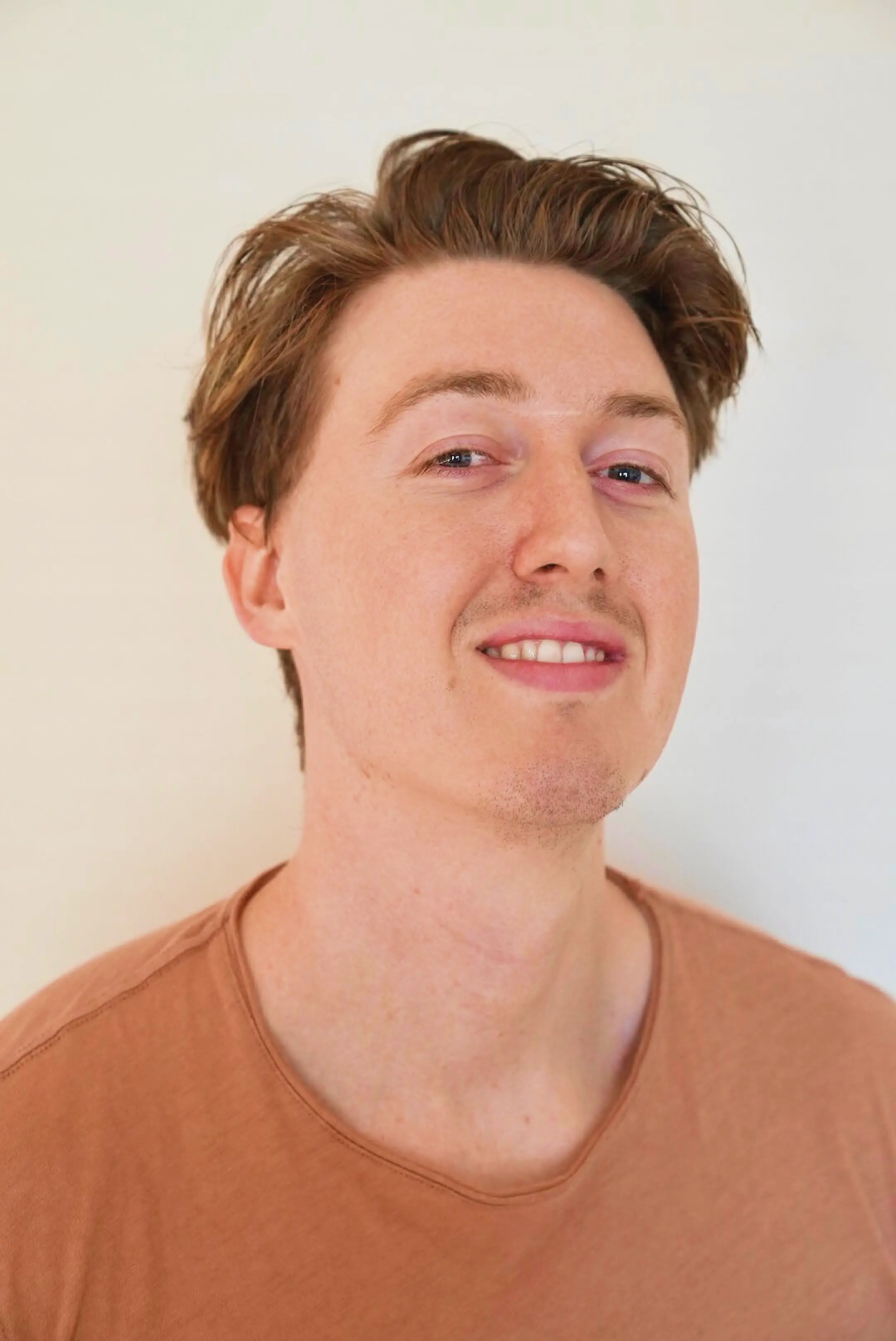 Javier, 26 after treatment